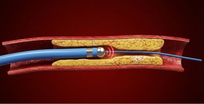 How to Use Visual Storytelling to Drive More Enterprise Sales 4 medical device