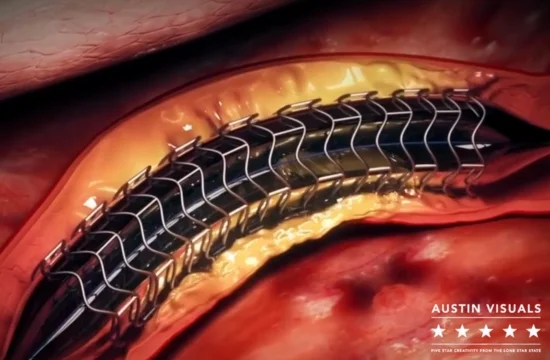 3D medical animation studio