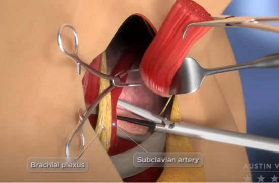 Georgetown Explainer Video Company 1 Medical Animation