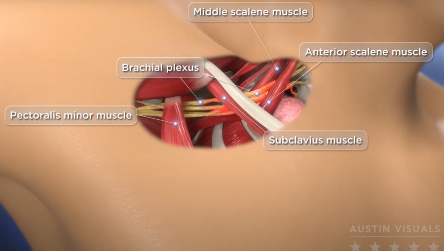 medical demo video