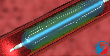 3D Animation of a Photonic Catheter In Action