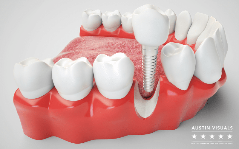 Austin Visuals: 3D Dental Animation Video