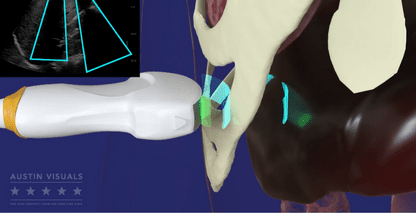 Ultrasound 3D Device Explainer Animation
