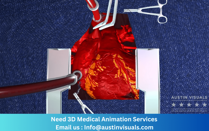 Screenshot of a 3D medical animation video produced by Austin Visuals showing a detailed view of a heart surgery procedure. The 3D model of the heart is shown along with surgical instruments and medical equipment, providing a realistic visualization of the procedure