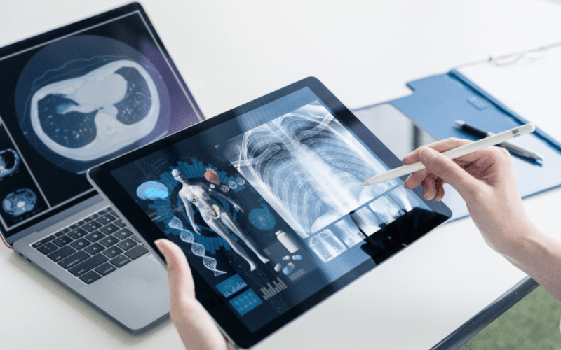 The Benefits of 3D Medical Animation for Medical Devices