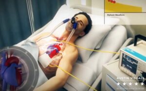 3D Medical Animation Company for Device Marketing 7 3D medical animation of a patient in critical care showing heart function and respiratory support devices with accurate medical detail by Austin Visuals