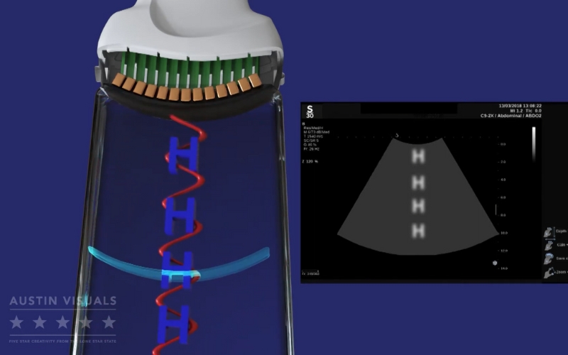 3d medical animation illustrating ultrasound probe technology and imaging process created by Austin Visuals for Hologic training videos