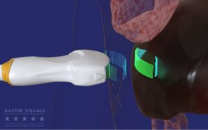 3d medical animation showing an ultrasound probe interacting with internal anatomy created by Austin Visuals for Hologic training videos