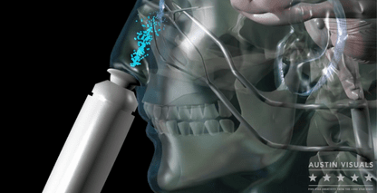 Neurotransmission – 3D Medical Animation: Alzheimer’s Treatment