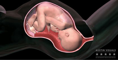 Childbirth 3D Medical Visualization | Austin Visuals