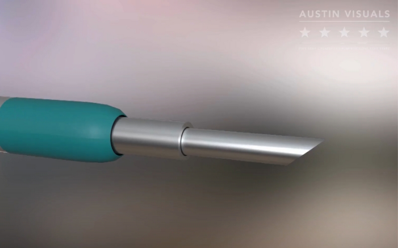 Custom Medical Device Animation