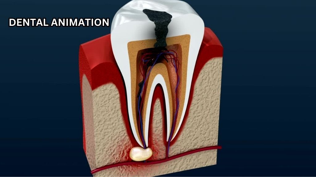 Dental animation