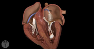 Heart medical device animation animation studio los angeles