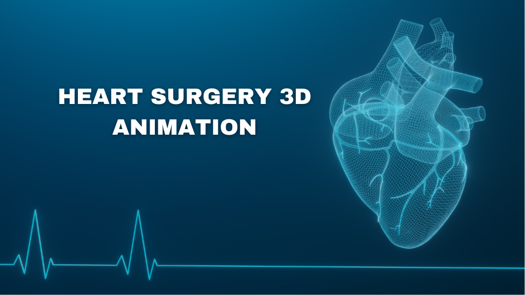 Heart surgery D animation Austinvisuals