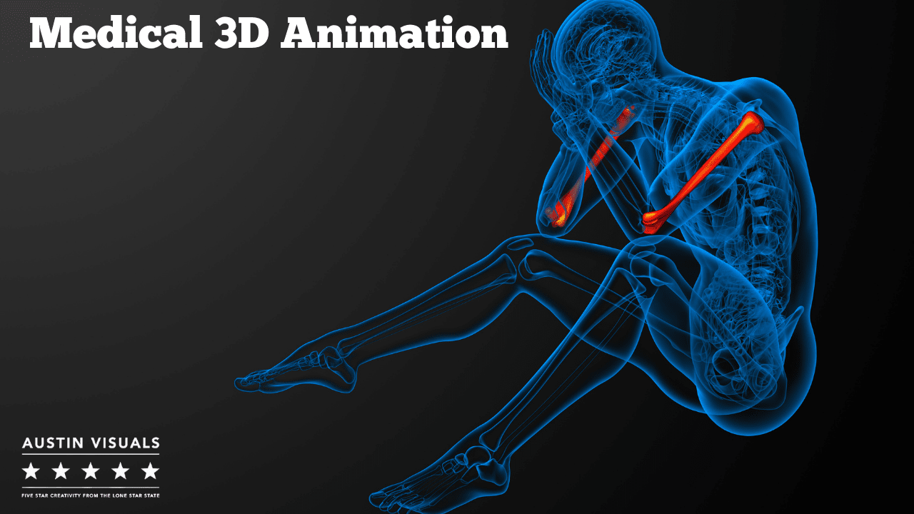 Medical 3D Animation