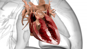 Medical_animation_heart-surgery-3d-translecent