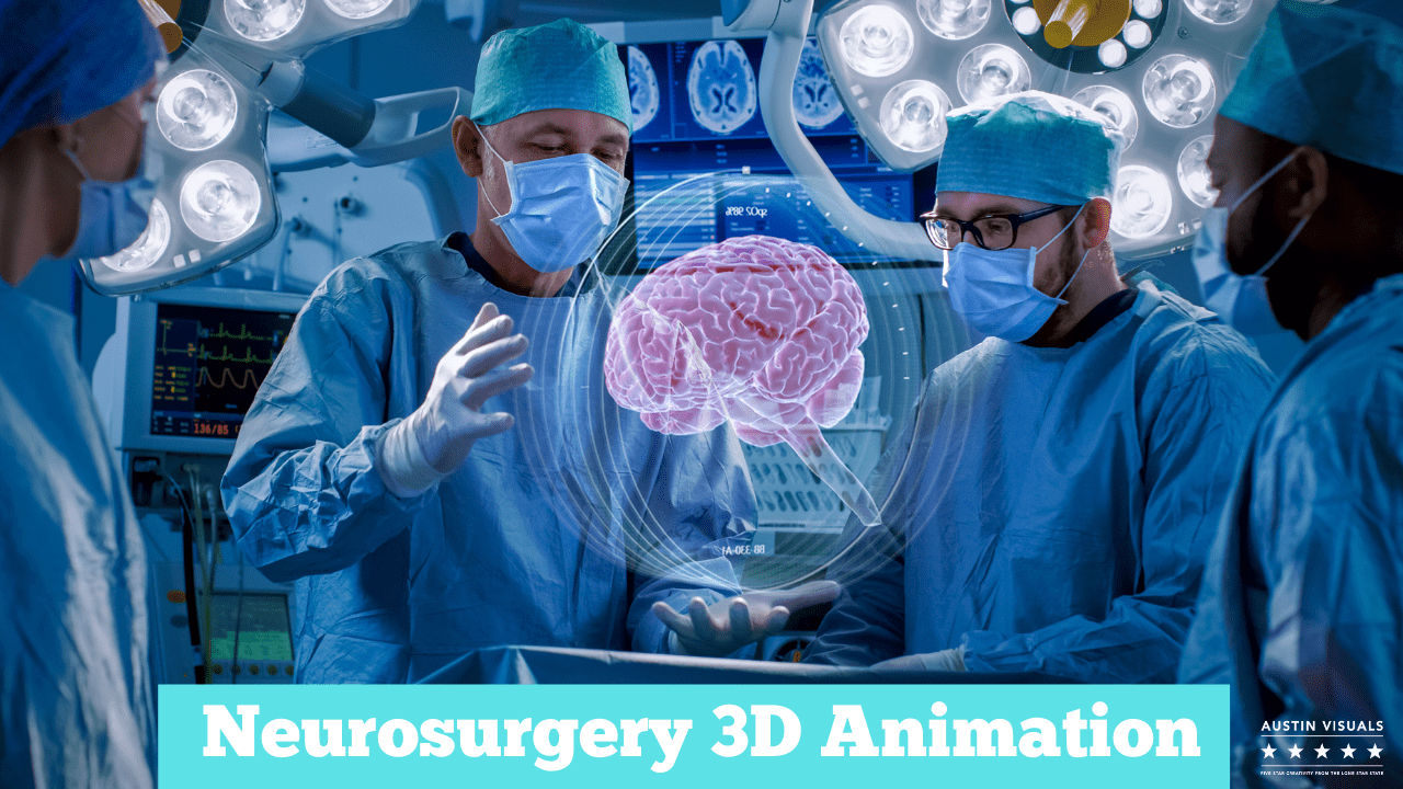Neurosurgery 3d animation