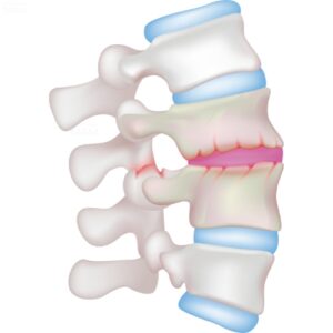 Orthopedic D ANIMATION