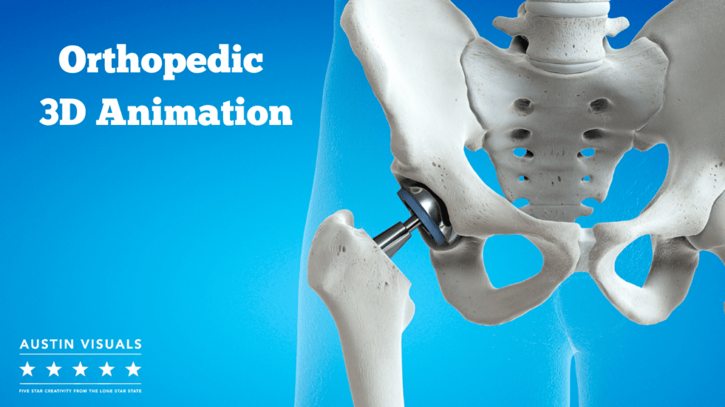 Orthopedic 3D Animation Services | Austin Visuals