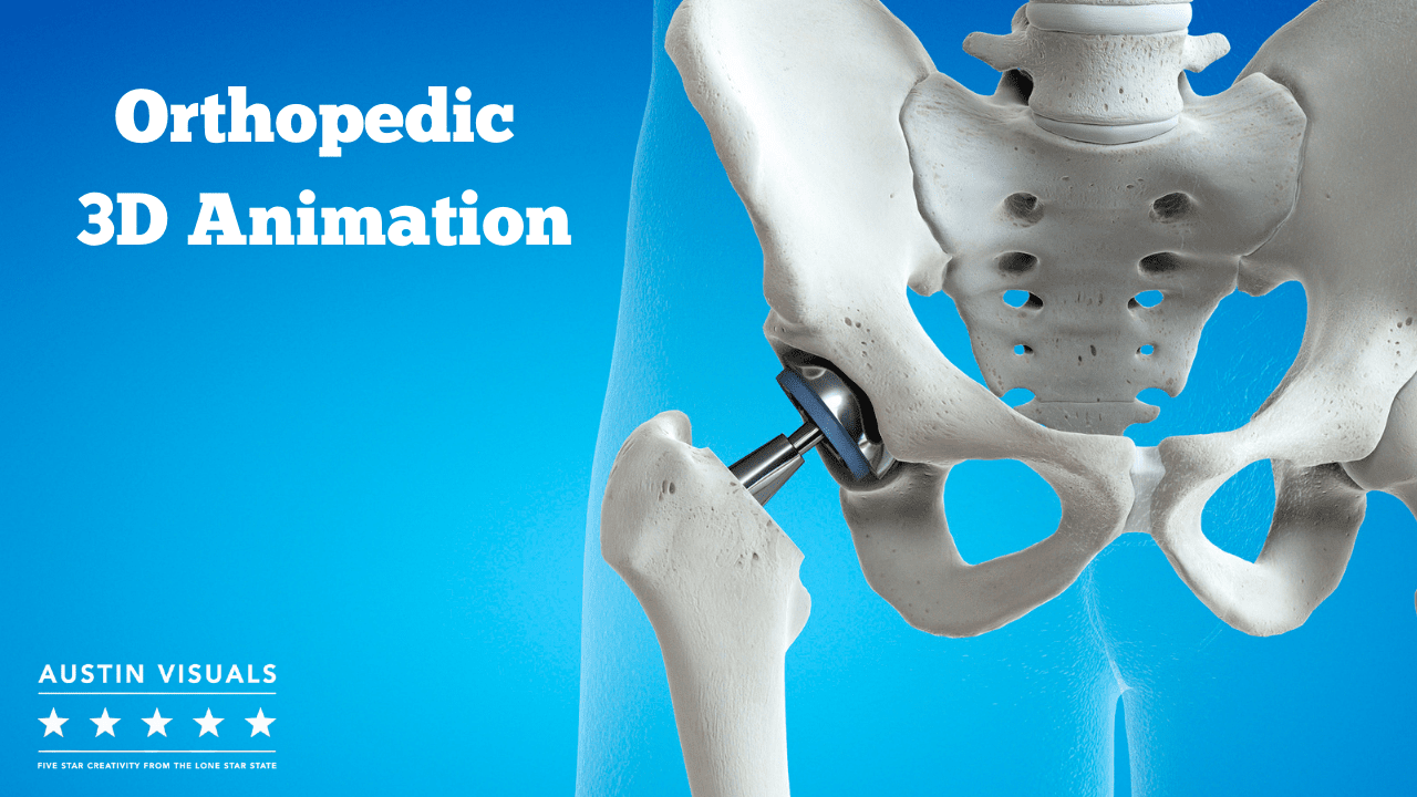 Orthopedic 3D Animation