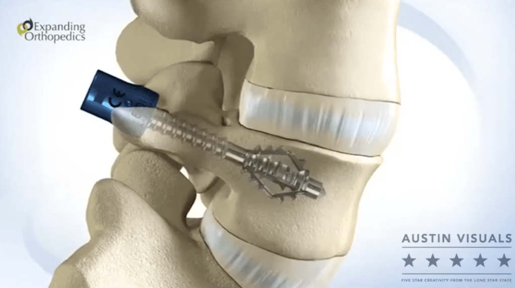 Osteopathic 3D Animation