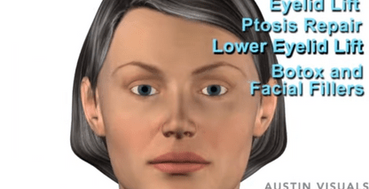 Plastic Surgery Reverse Aging 3D Medical Visualization