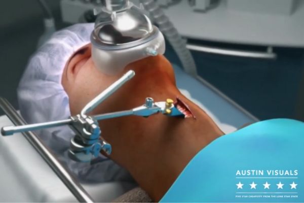 Surgical animation