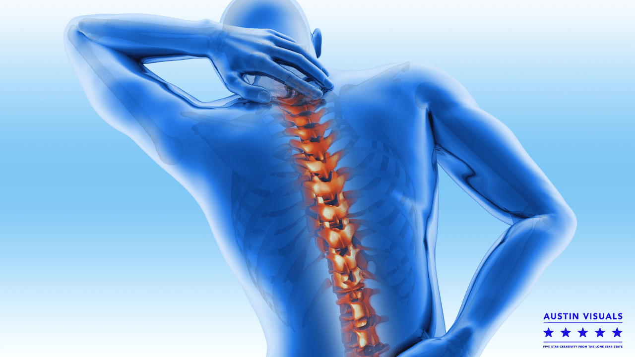 Medical Animation for Spine Surgery