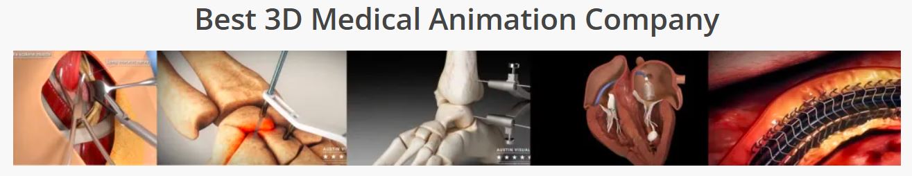 best medical d animation company