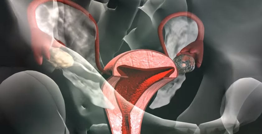 Ovulation Fallopian Tubes 3D Medical Animation