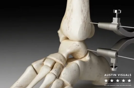 medical animation