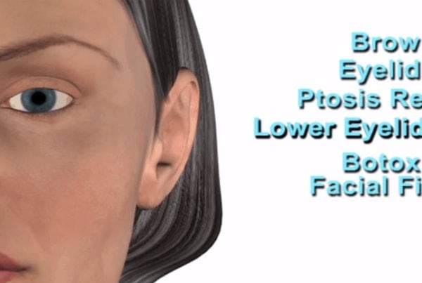 Plastic surgery - Forehead plastic surgery reverse aging medical device respiratory 3d medical explainer video website 3d medical animation company studio 3d visualization health care San Antonio